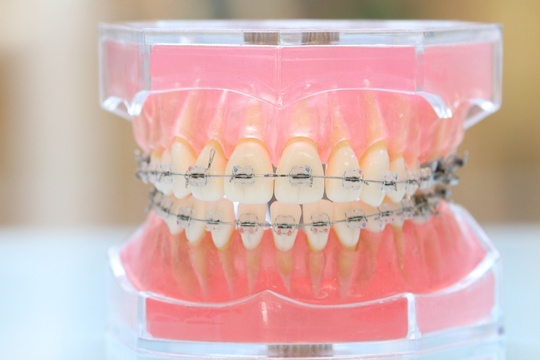 矯正歯科・矯正治療 - 鈴木デンタルクリニック（浜北区）